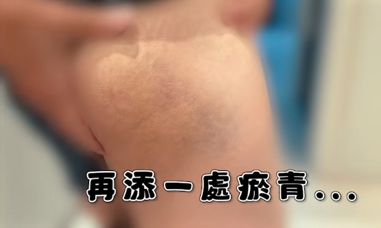 蔡阿嘎在日本被打！慘遭店員「賞巴掌、揍肚子」全被拍　畫面流出網嚇：好痛