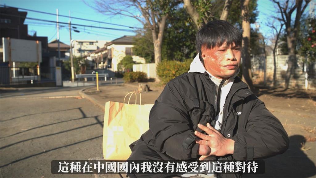 殘疾男曝「在中國看不到希望」　赴日後感動喊：第一次被正常對待