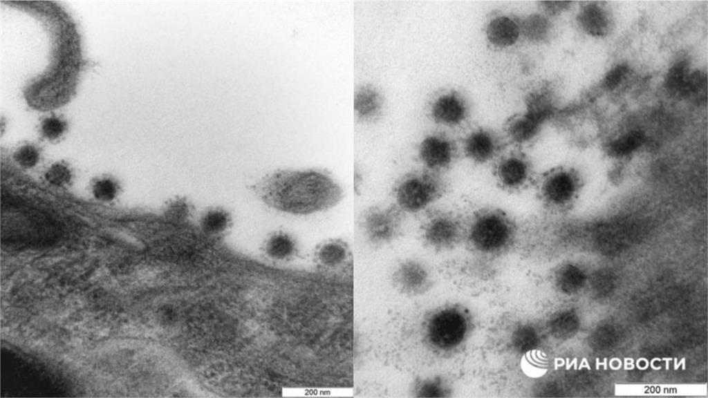 武肺最強變種Delta「真面目」曝光　俄羅斯公布顯微鏡下真實樣貌