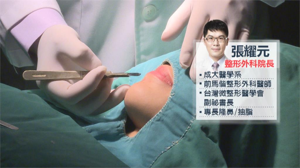 整形名醫張耀元 性侵判四年發監前喊冤
