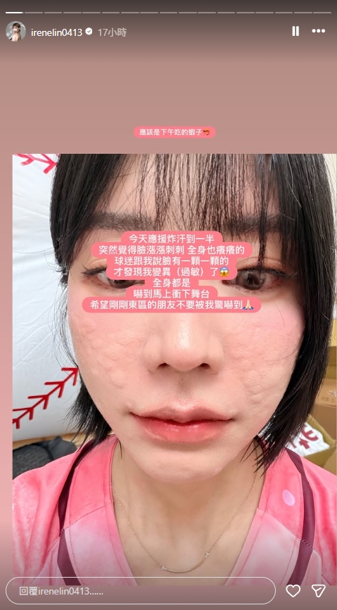 「中職最正MC」應援一半「突滿臉冒顆粒」嚇到衝下台！臉蛋全毀近照流出