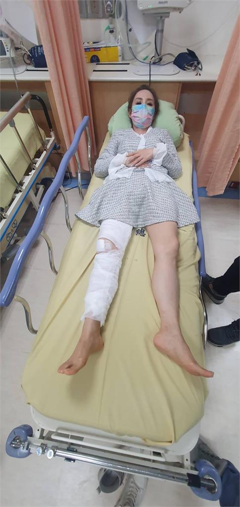 名嘴許聖梅驚傳重傷送醫「軟骨碎2半」 憔悴躺病床畫面曝