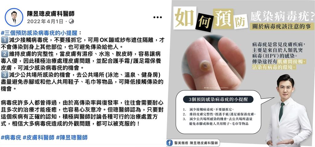 做美甲流血崩潰確診此病!醫:冷凍治療痛十次千萬別抓 曝潛伏期長難追源