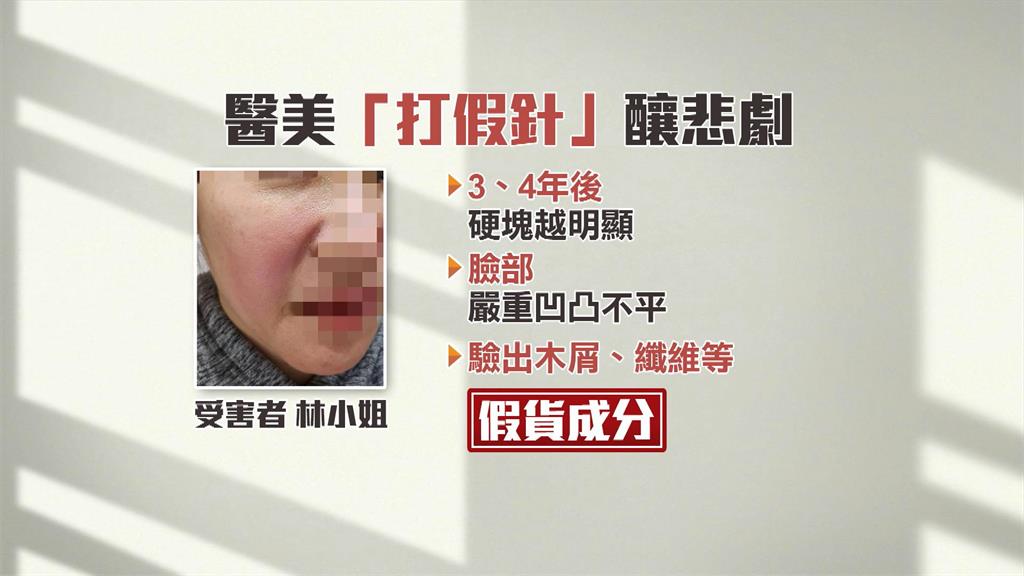 「少女針」假貨橫行! 女想變漂亮卻慘遭毀容