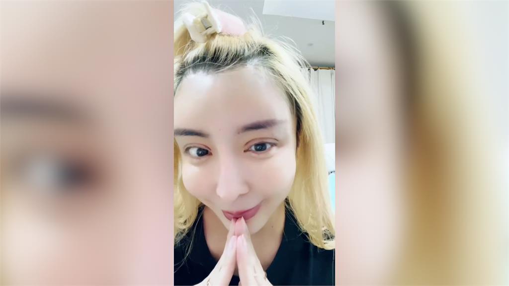 不是為了美!雪碧曝眼睛第3次動刀現況 嘆「容貌焦慮」求網友放過她