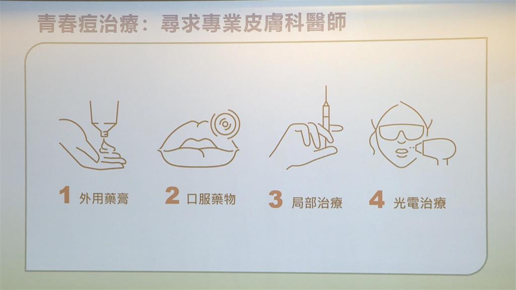 壓力、作息影響3成成人長「背痘」 醫生:及早治療效果越好