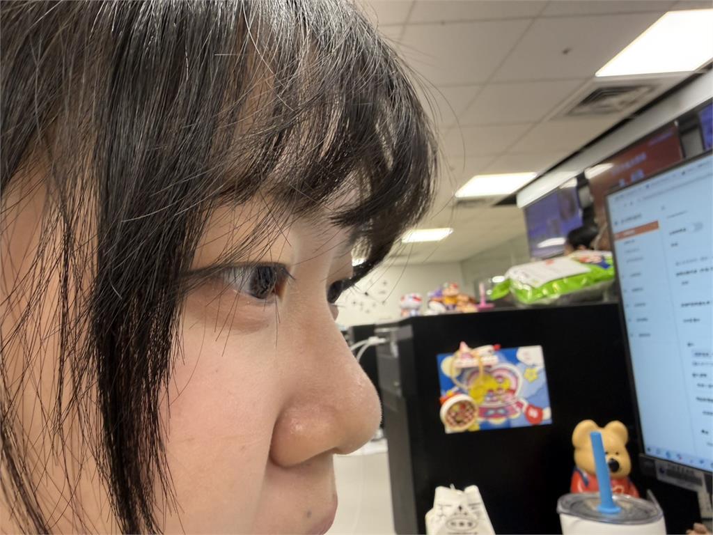 睫毛上其實有蟲!醫曝「九成人中招」:嚴重恐掉睫毛…6症狀要注意