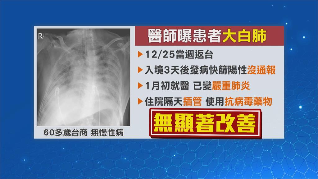 台商返台發病重症「大白肺」 醫:留在中國應該死路一條