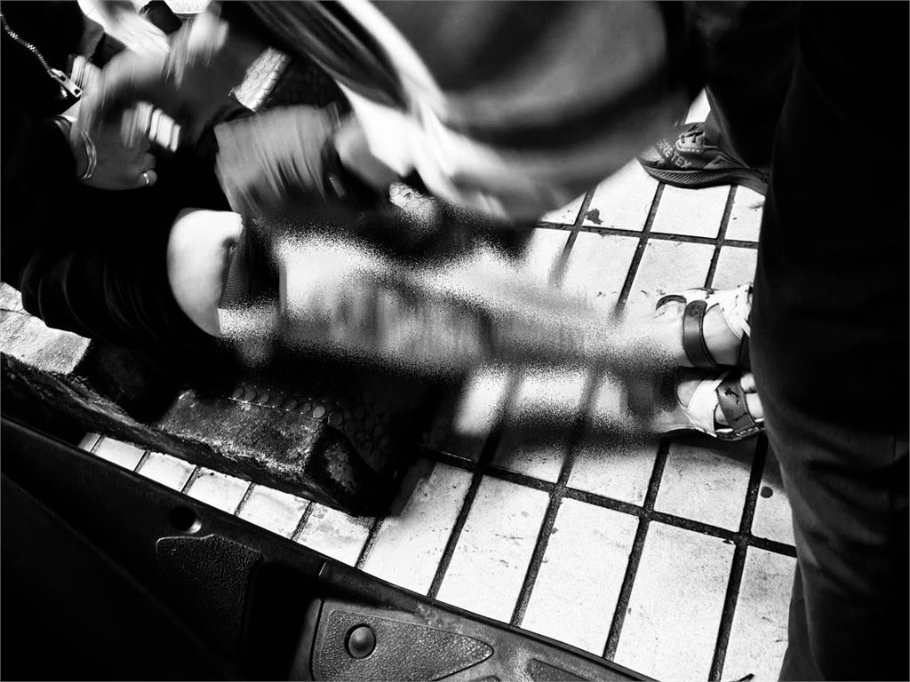 好痛！水溝蓋生鏽害踩空　女子腿部皮開肉綻縫30幾針