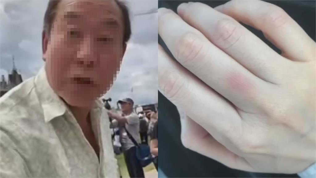 高喊「支持加拿大」被老粉紅襲擊 她怒:已到警局立案