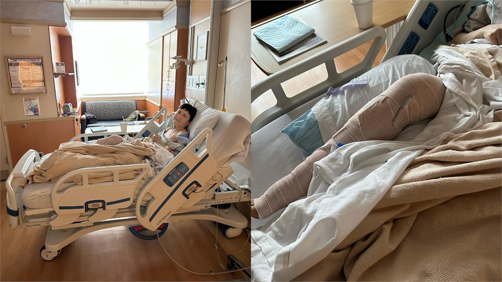 58歲金馬影后「滑雪事故」送醫搶救！「虛弱躺床」手術結果曝：我會活下去