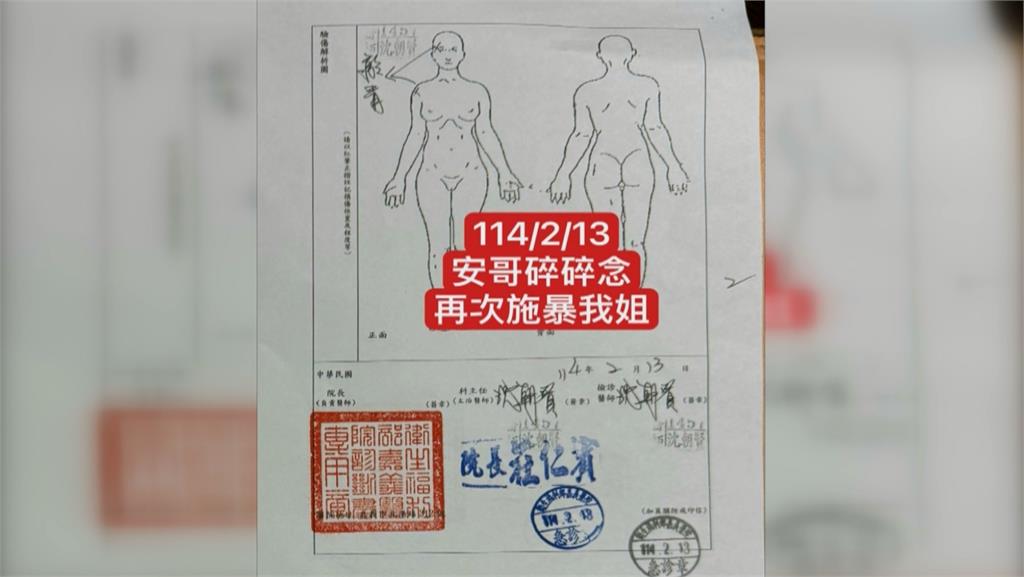 網紅安哥公司被潑漆 女友「突離世」弟弟控家暴致死