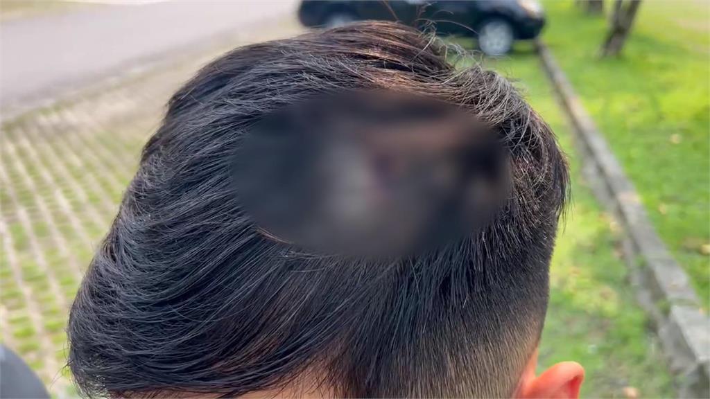 情侶逛夜市吵架! 親哥替妹出氣 猛毆男友害多處傷