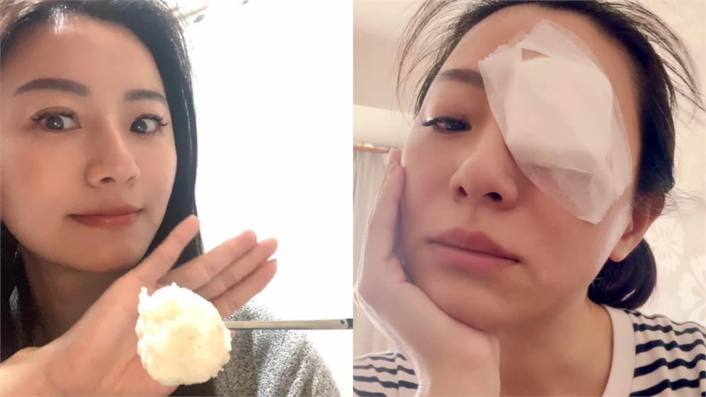 民進黨美女議員自爆「遭民代闖房猛摑掌」！本人「神隱一天」猛甩3聲明發聲了