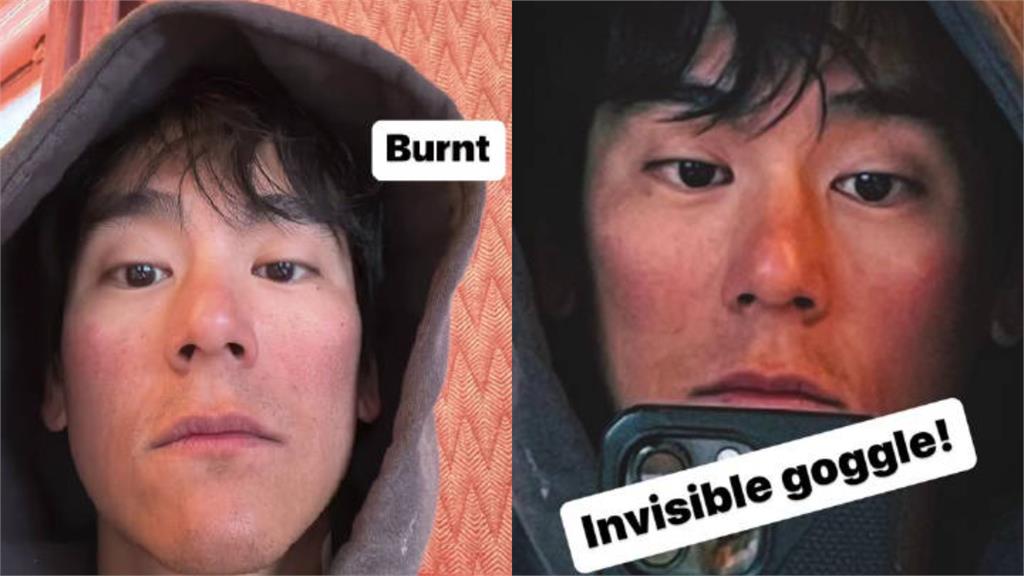 男神彭于晏滑雪「嚴重曬傷」雙頰通紅!全臉皺紋「崩壞照」驚呆粉絲