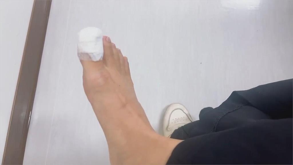 好痛！台南民眾市場買菜被米奇咬傷　市場管理單位回應了