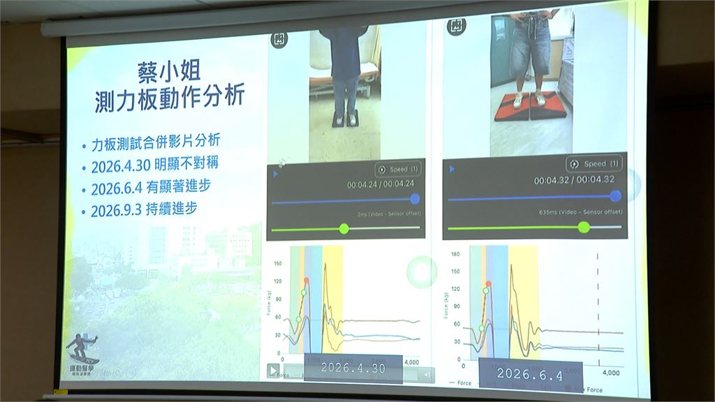獨／海外滑雪風氣日盛　北榮首創「滑雪運動醫學門診」為雪友照護把關