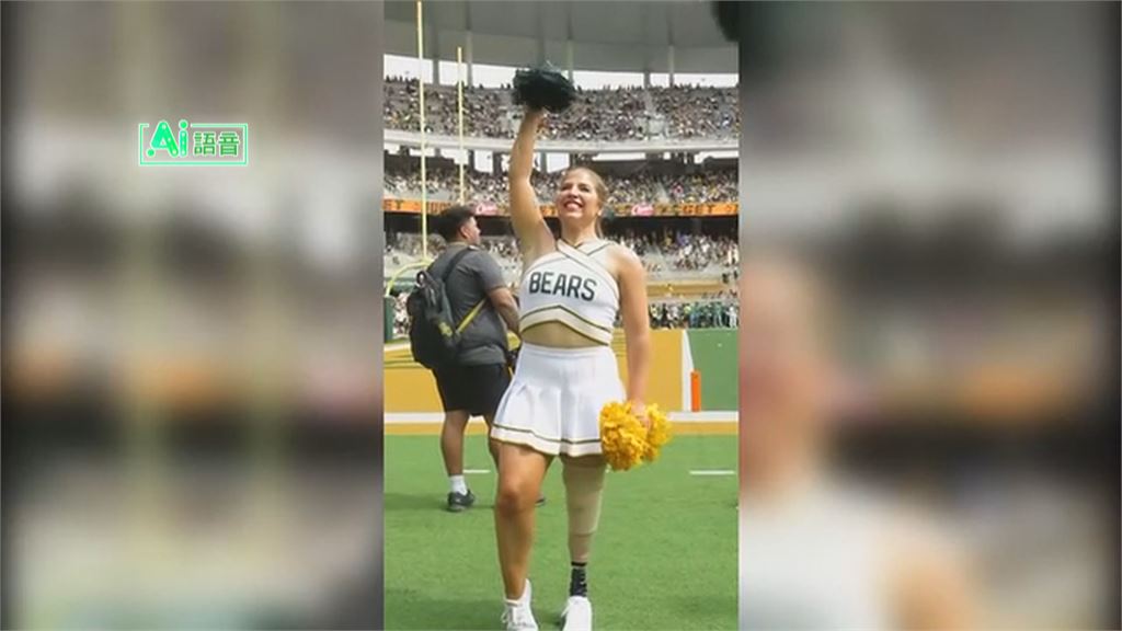 追夢!失去左腿不放棄持續復健 美國女孩成功加入大學啦啦隊