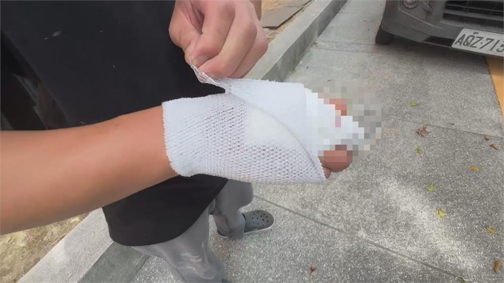 超派！中山大學生遭獼猴搶食　手被抓出長5公分撕裂傷痕