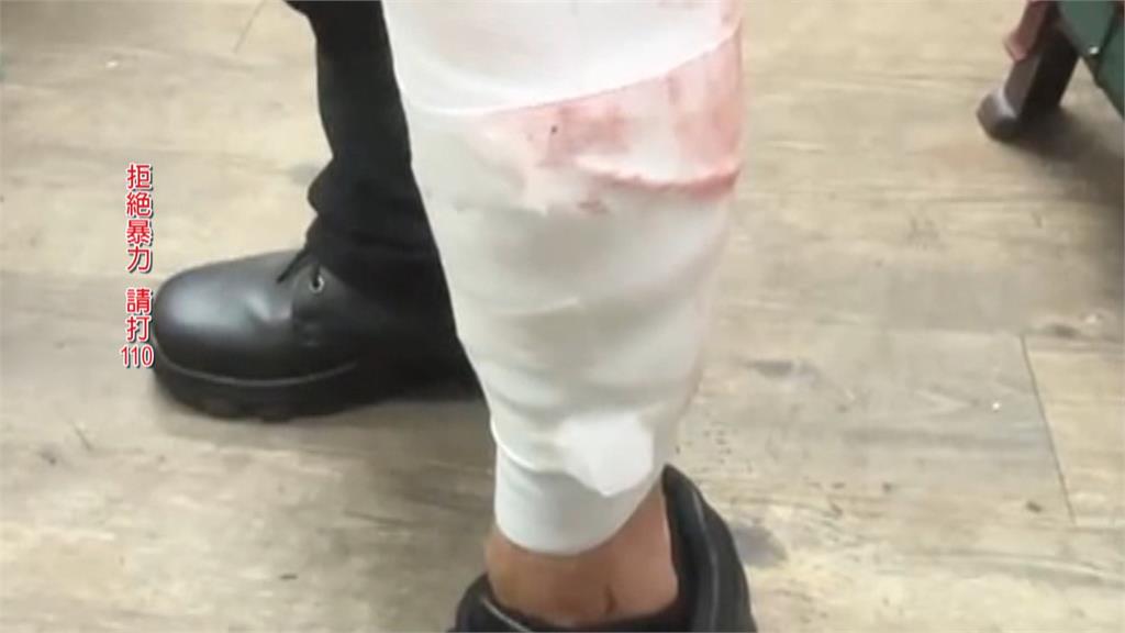 剛聲請家暴保護令！　60歲女持美工刀闖店刺傷機車行老闆