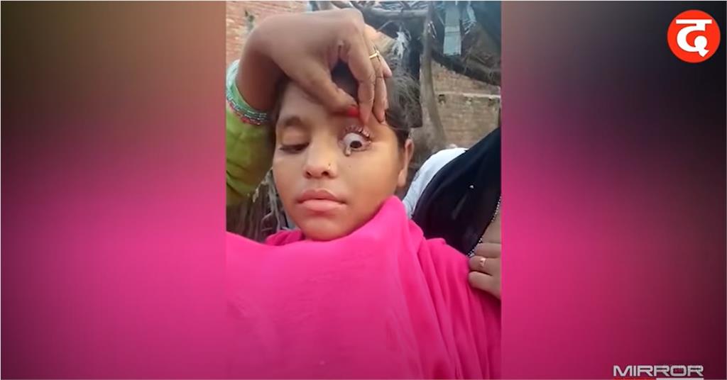印度15歲少女不流淚改掉「石頭淚」！醫學謎團看診也找不出病因