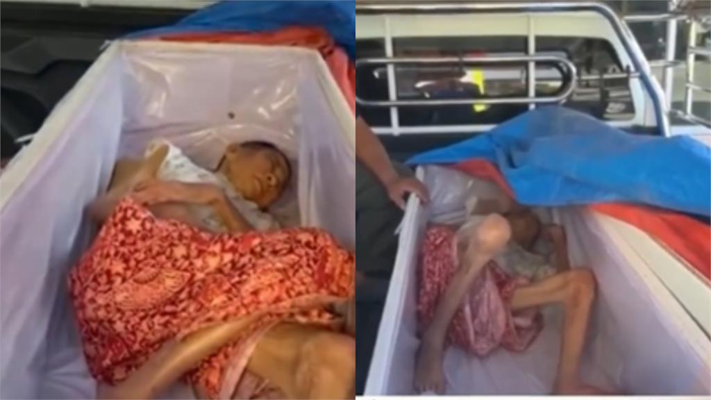 65歲婦人「死而復生」狂敲棺材！親弟激動流淚：差一點就送去火化