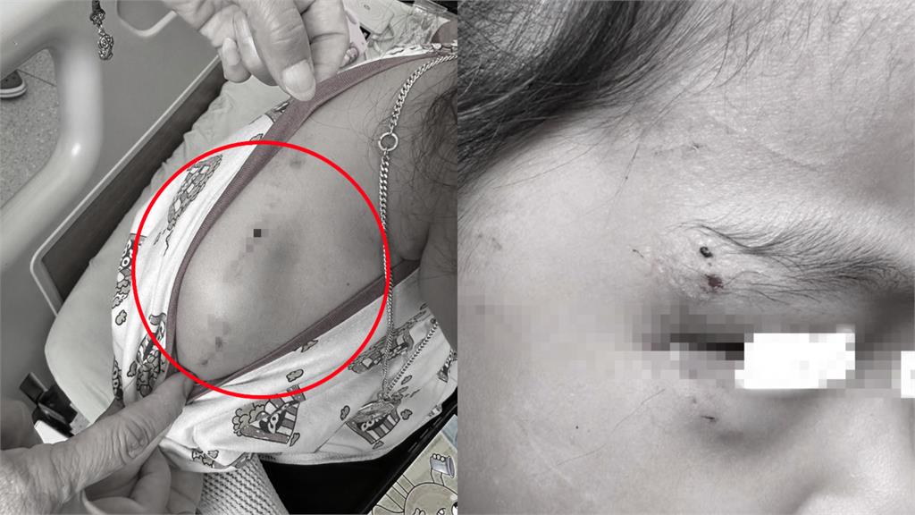 三義商店街黑狗「突暴衝咬3女童」！驚險畫面曝光…店家喊冤：狗不是我養的