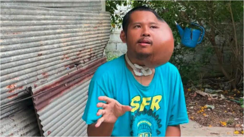男長期拿1硬物「掏洞」下場超慘！這部位「腫出超巨一顆」震撼畫面曝