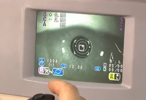 配一副眼鏡要破萬…他疑被當「盤子」 內行曝真相遭網酸:是能跟製造商買?