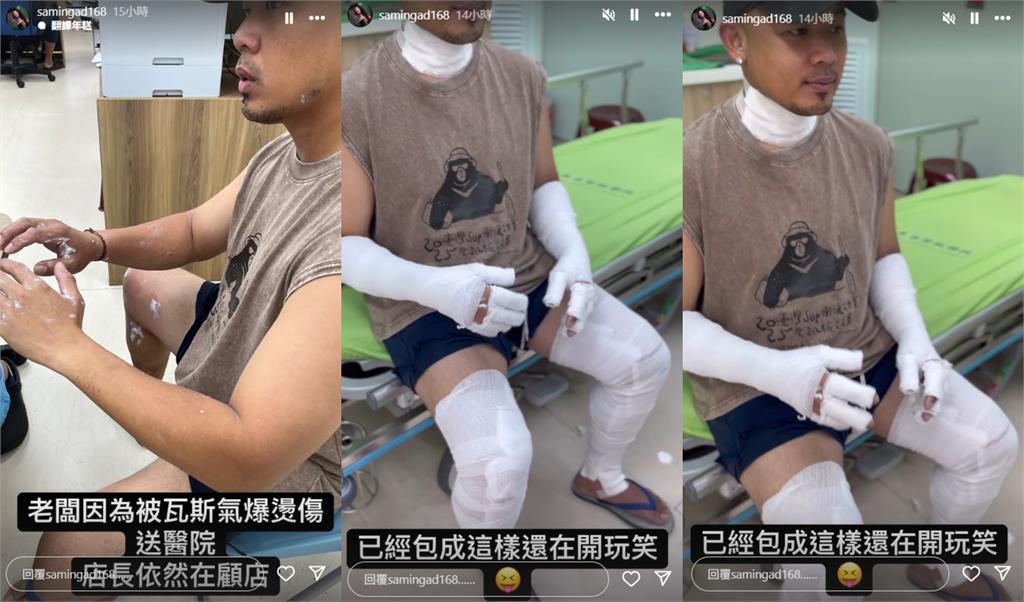 老公遇氣爆全身包紗布「金曲歌后」心疼喊:太難過我睡不著 紀曉君老公遇氣爆「大面積燒燙傷」!她心疼曝真實狀態:我都在你的身邊