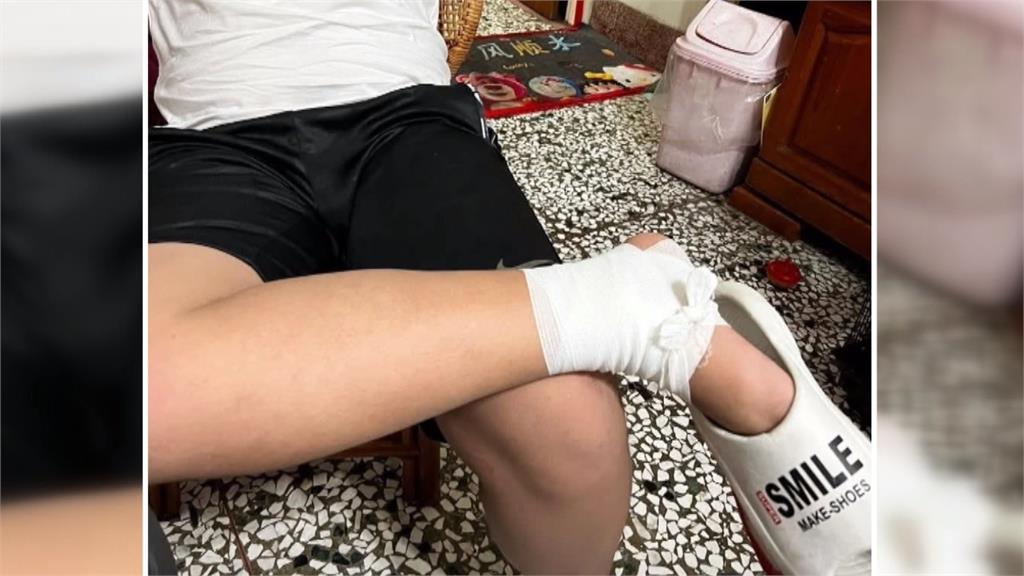 "漏網之狗"肇事逃逸! 國中生遭狗追自撞 慘噴飛摔進溝