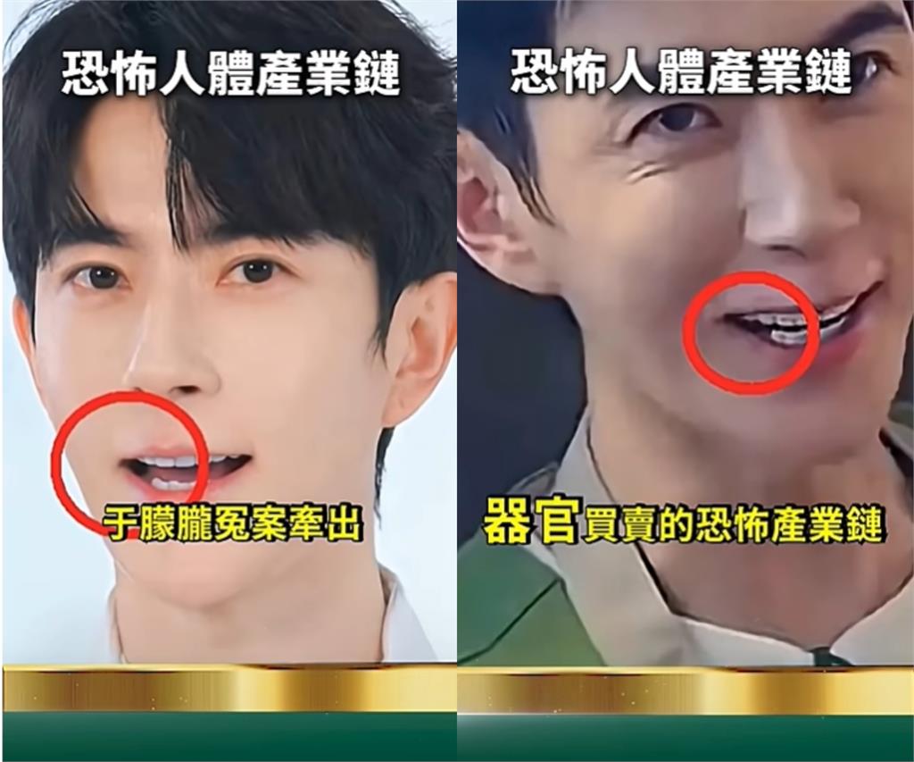 于朦朧命案揪出「人體加工鏈」黑幕?他曝中國肉丸、化妝品竟驗出「DNA組織」