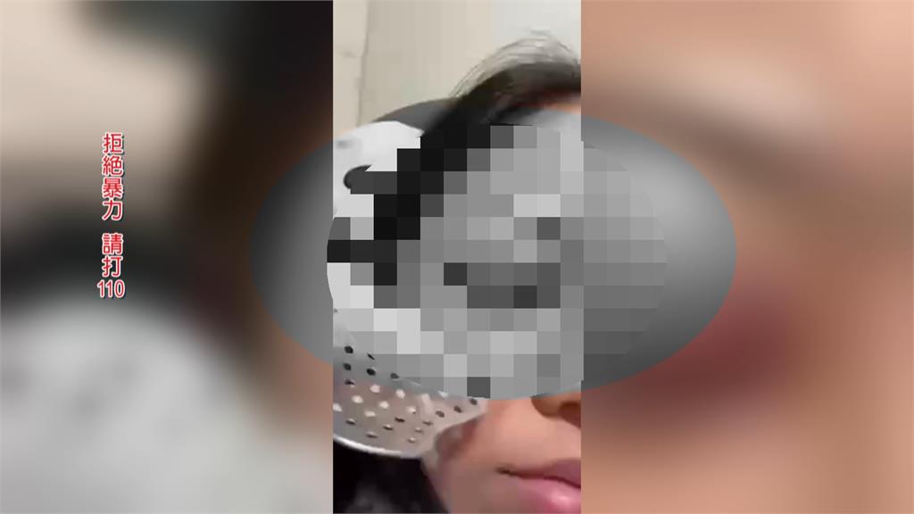 恐怖情人！新北中和男疑求和不成暴打前女友　害左眼水晶體脫落恐失明