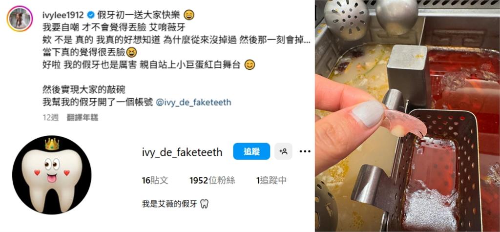 蕭敬騰師妹「假牙掉在小巨蛋」心都碎了!拍片自嘲「真厲害」300萬人笑瘋