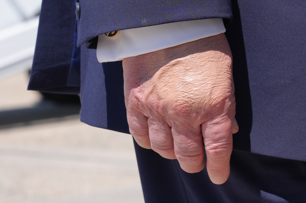 下個月將滿80歲！川普13個月內第3次「年度健檢」親曝結果：一切完美