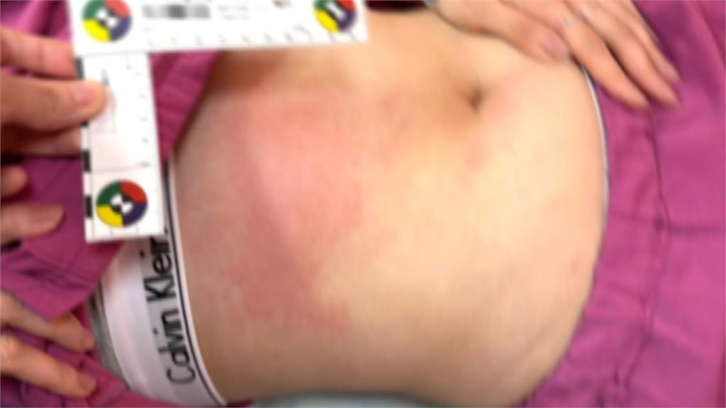譴責醫療暴力！　癲癇送醫不配合　男猛踢護理人員