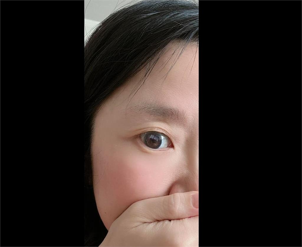 陶晶瑩狠甩青蛙臉宣布「割雙眼皮」！0修圖近照曝光　網見全笑瘋：愚人節快樂