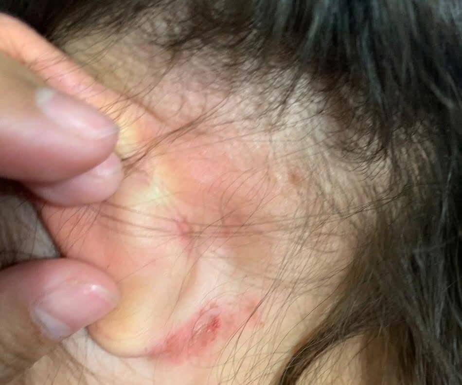 老師喊「我要修理人囉」　女童沒帶備用衣物竟被打