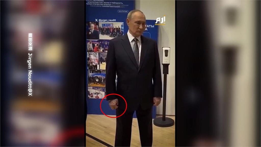 普丁健康亮紅燈？ 右手腫脹如「麵龜」  血管明顯隆起