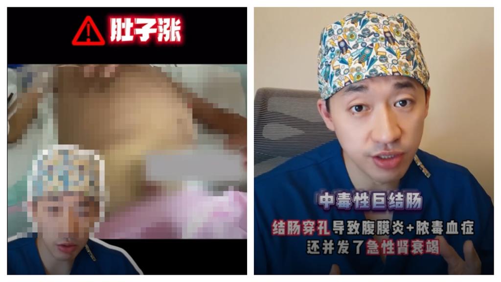 結腸穿孔險喪命！9歲童吃夜市「1食物」緊急進ICU　醫曝關鍵原因