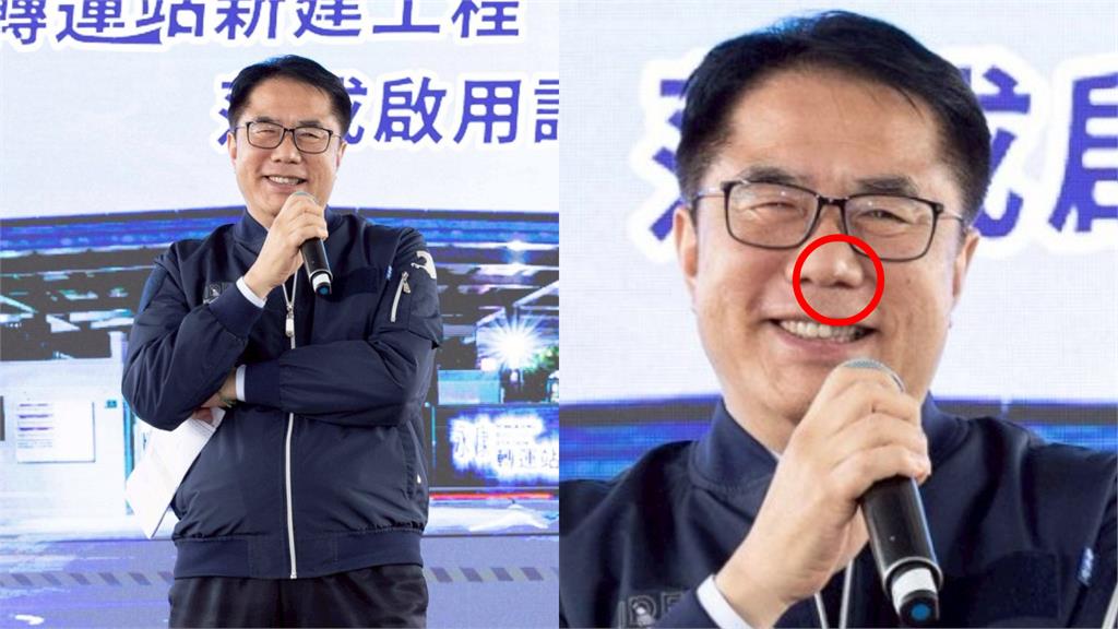 新一代「戰痘男神」誕生？黃偉哲曬「清晰私照」湧15萬人朝聖：還很青春耶