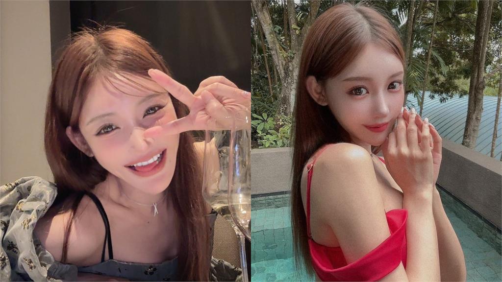 明日花綺羅曬「門牙缺角照」迎新年　本人親吐真相：腦海中只剩「不能死」！