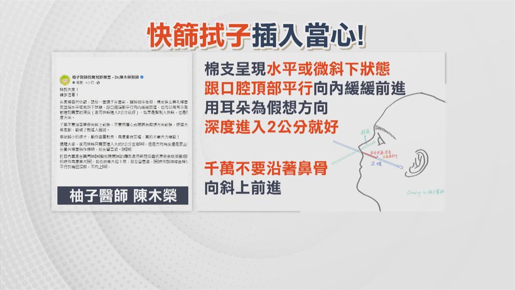 快篩棉棒插鼻　應與口腔頂部平行勿推入眉心