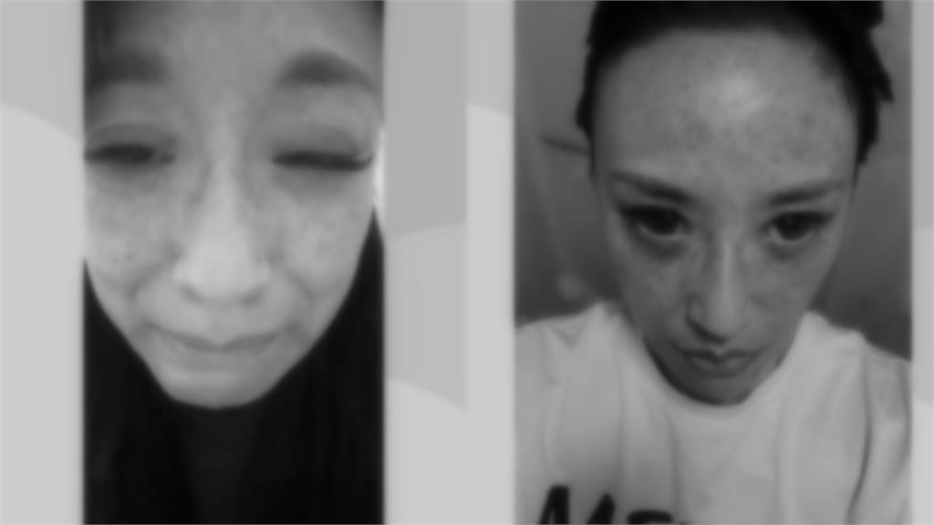 安歆澐突發不自殺聲明！公開遭尪勒脖「血管大爆裂」傷勢照：還是擔心被傷害