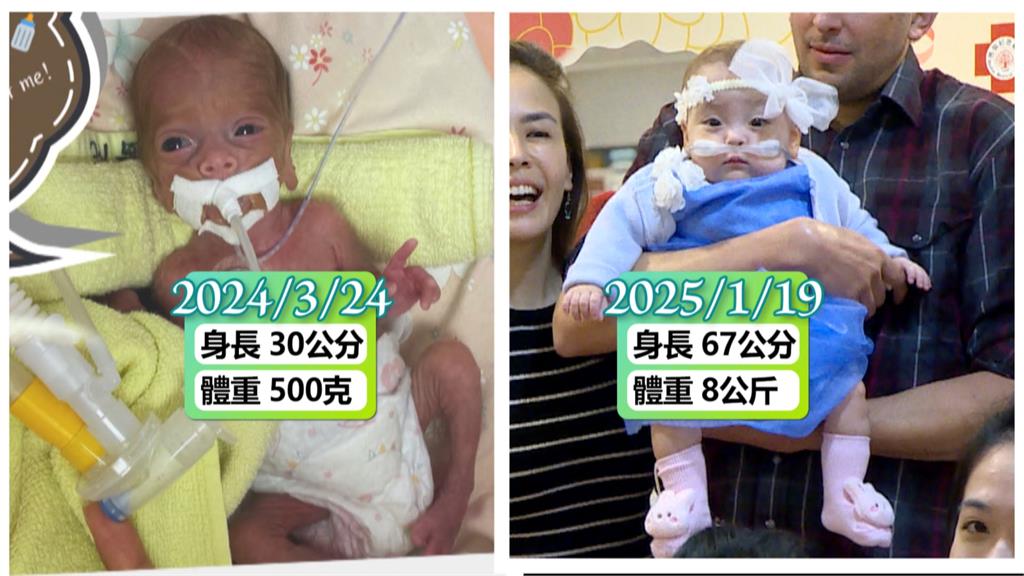 台美混血兒早產出生 體重僅500公克搶救61天存活...來到人世首度出病房