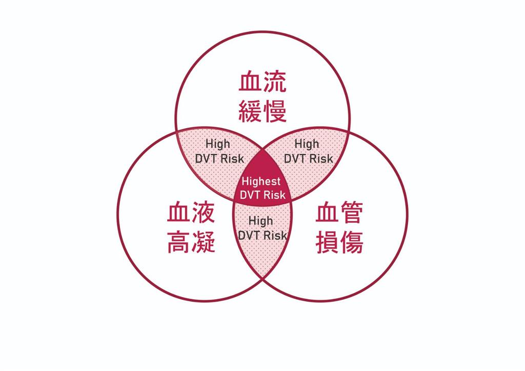 被忽視的靜脈殺手!醫談深層靜脈栓塞