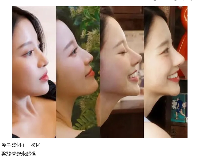 蔡瑞雪抬頭驚見「小木偶尖鼻」遭疑整型!4階段進化震撼網:比小蘭頭髮還尖