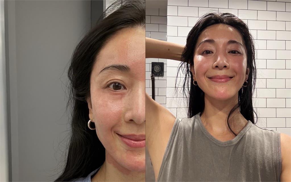 隋棠爆「倍速老化」認了做醫美！術後「素顏真面目」曝光：肉眼可見差異