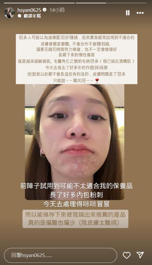 筱崎泫PO「大臉職災照」長滿粉刺 苦嘆「很多人以為業配很好賺」