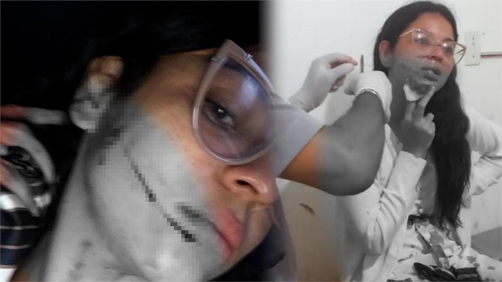 驚悚!網紅公車小睡一半痛醒 驚見陌生女拿刀「從嘴到耳」割臉